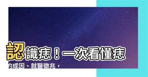 為何會長痣|痣是什麼？一次了解痣原因、就醫時機以及如何改善